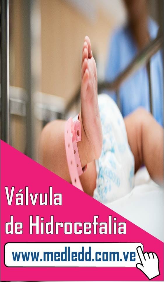 Descuento para Válvulas De Hidrocefalia