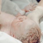 Hidrocefalia neonatal
