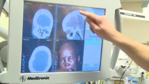 Imágenes del cráneo desde monitor de rayos X.