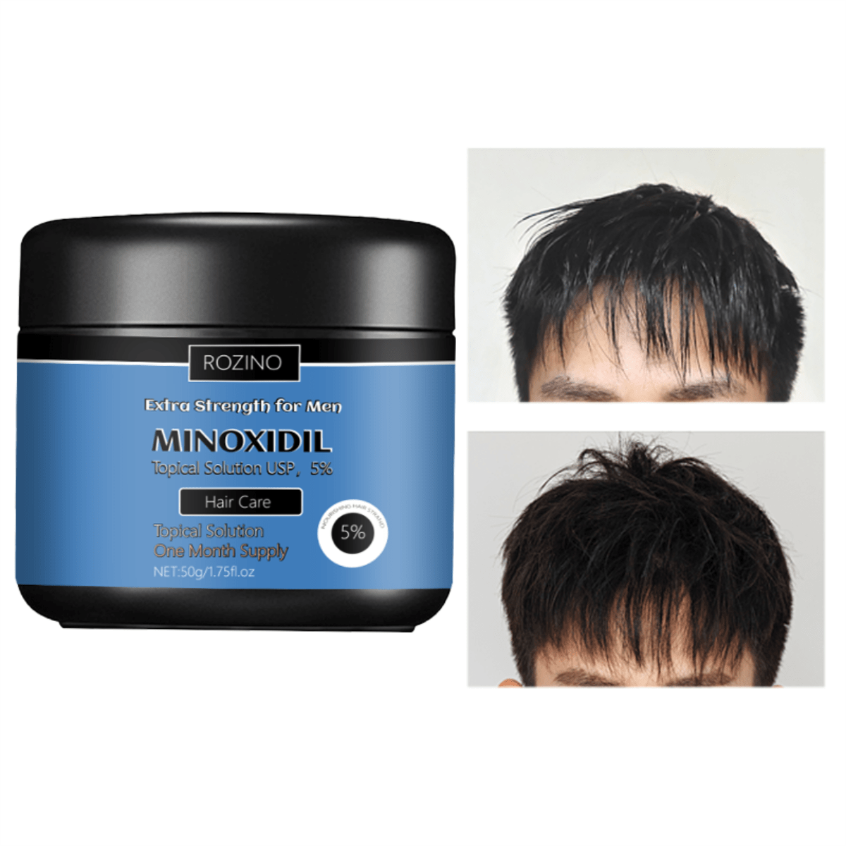 Minoxidil 50g hombre, tratamiento anticaída capilar, crecimiento cabello masculino,