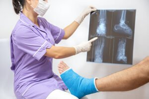 Fracturas metatarsales Tratamiento y recuperación