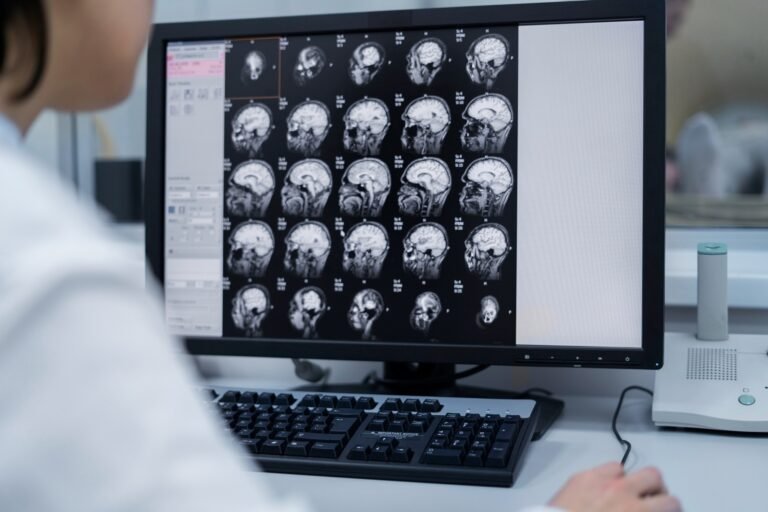 Mallas de Craneoplastia Personalizadas, Innovación en Reconstrucción Craneal MEDLEDD